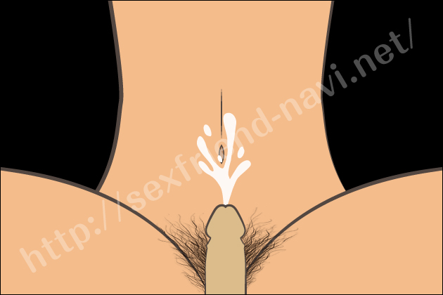 �Z�b�N�X�̔�D���@�Ɣ�D���I�]�܂Ȃ��D�P���m���ɔ�������D��Ƃ́H