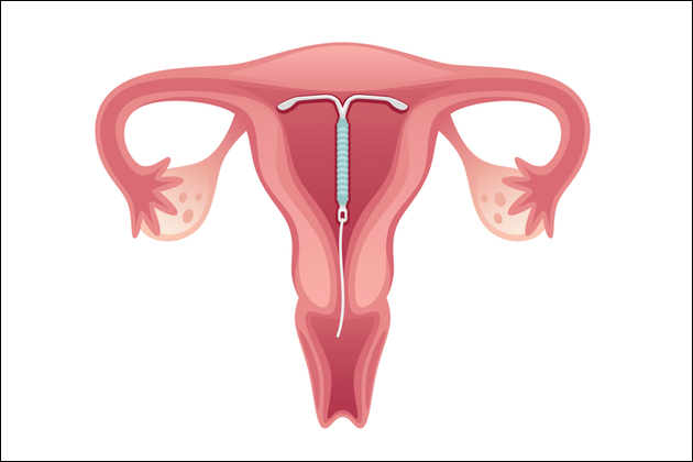 �Z�b�N�X�̔�D���@�Ɣ�D���I�]�܂Ȃ��D�P���m���ɔ�������D��Ƃ́H