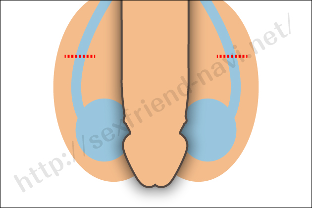 �Z�b�N�X�̔�D���@�Ɣ�D���I�]�܂Ȃ��D�P���m���ɔ�������D��Ƃ́H